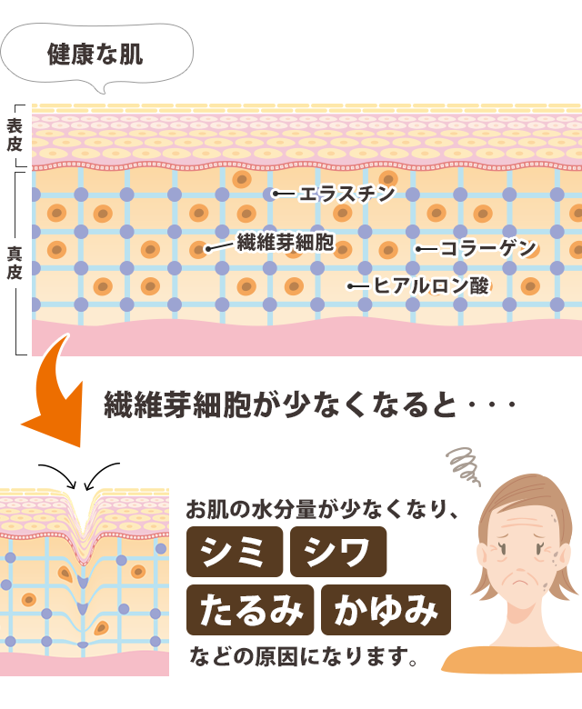 肌トラブルの原因