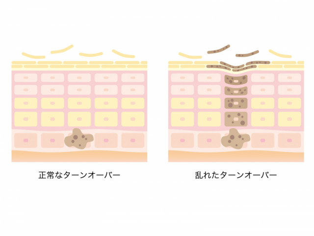 肌 イラスト